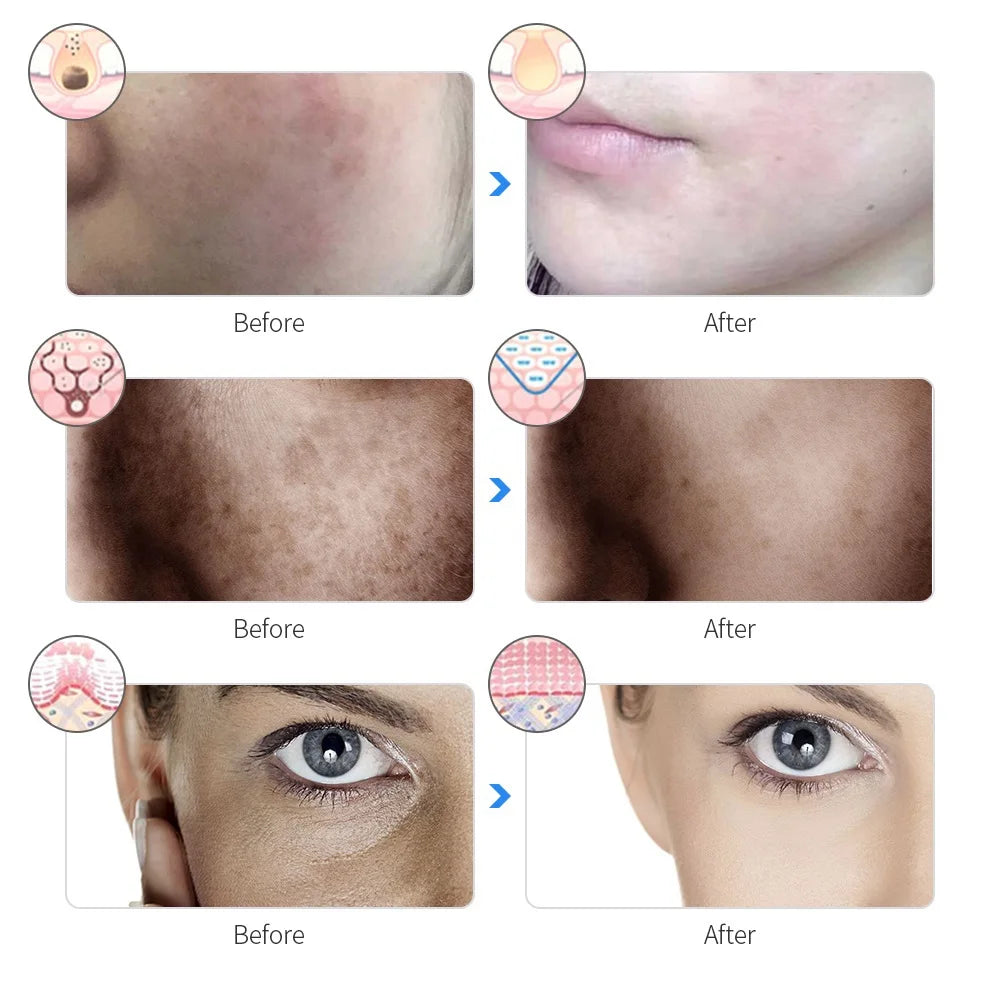 Advanced LED Facial Beauty Mask